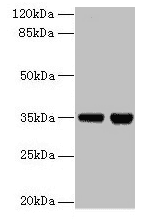 ZBED1 / TRAMP Antibody