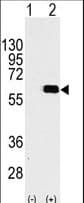AKT2 Antibody (Ser474)