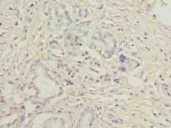 LRG1 / LRG Antibody