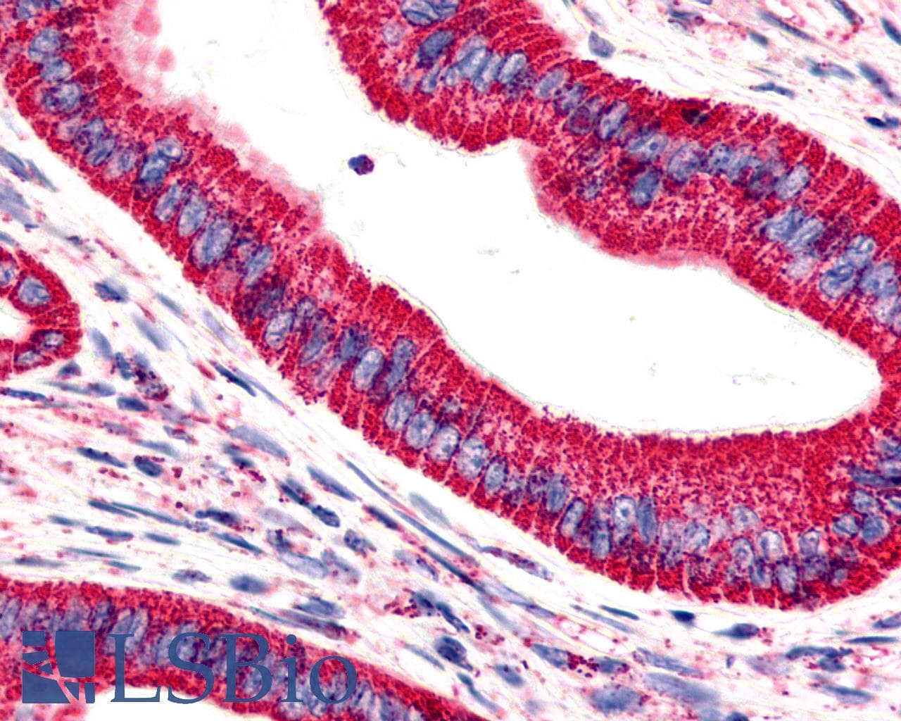 PathPlus™ ADGRG6 / GPR126 Antibody (C-Terminus)