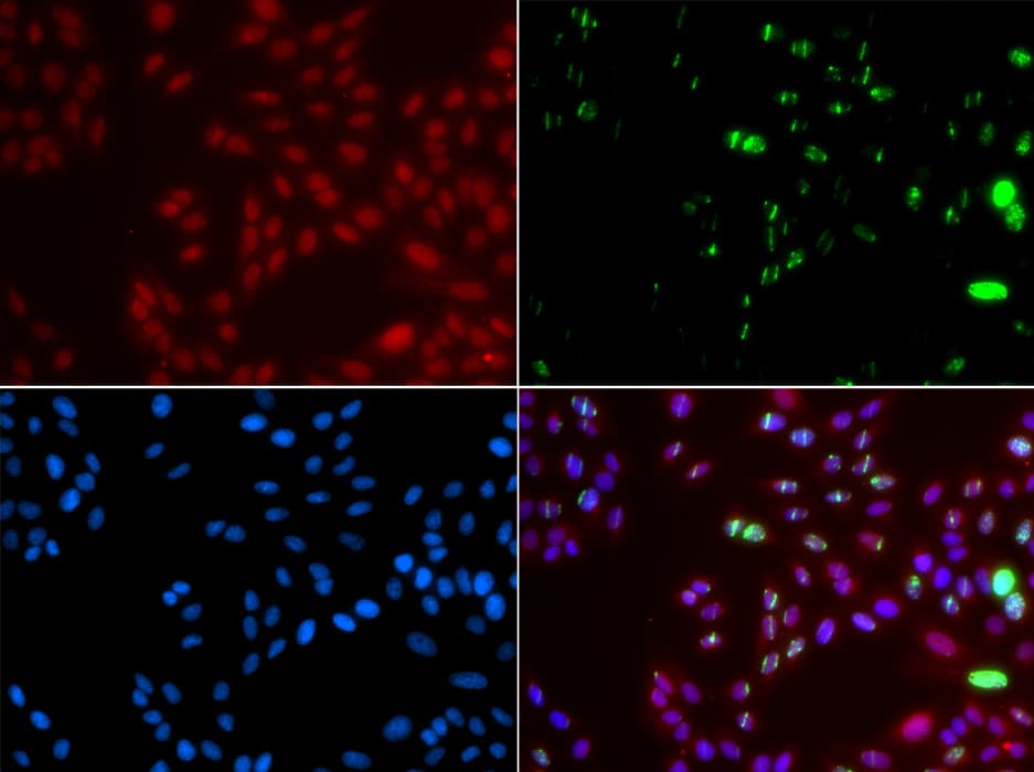 XPA Antibody
