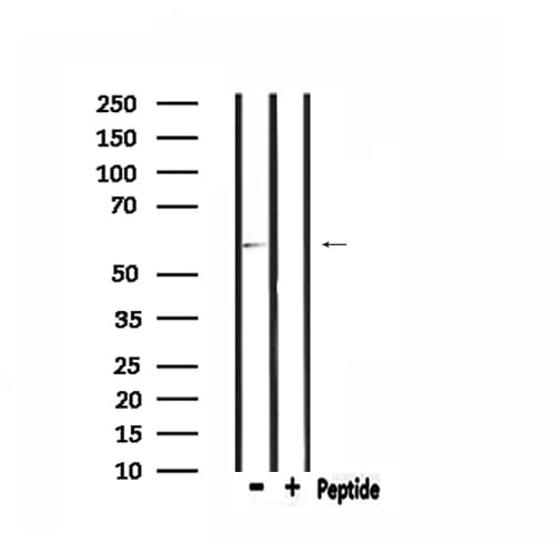 TFB1 / GTF2H1 Antibody