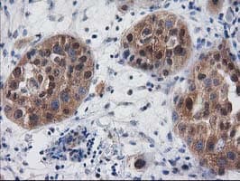 Monoclonal Mouse anti-Human DSTN / Destrin Antibody (clone OTI1B8, IHC, WB)