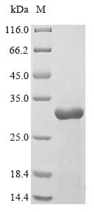 Zebrafish IL-1B / IL-1 Beta Protein (Recombinant 6His, N-terminus)