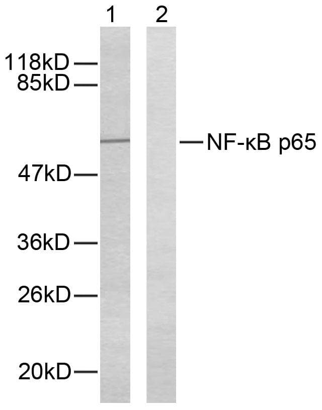 RELA / NFKB p65 Antibody (p276)