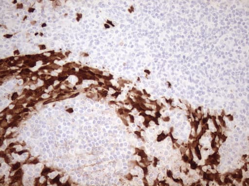 S100A9 / MRP14 Antibody (clone OTI13E12)