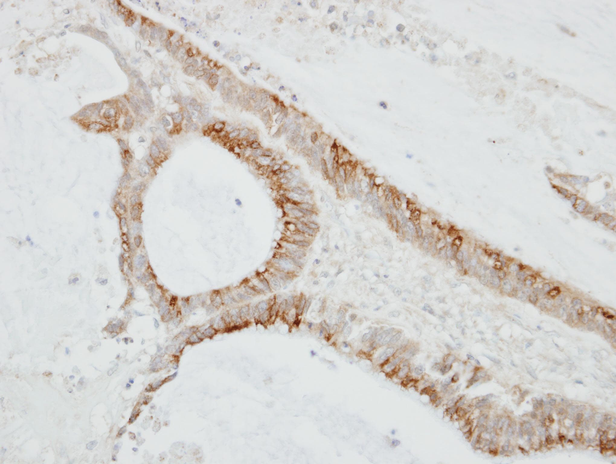 CMTM6 / CKLFSF6 Antibody (aa119-183)