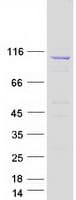 Human ATP2A3 / SERCA3 Protein (Recombinant Myc-DDK (Flag))