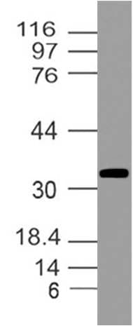 IHC-plus™ Monoclonal Mouse anti-Human GAPDH Antibody (clone ABM22C5, aa120-320, IHC, WB)