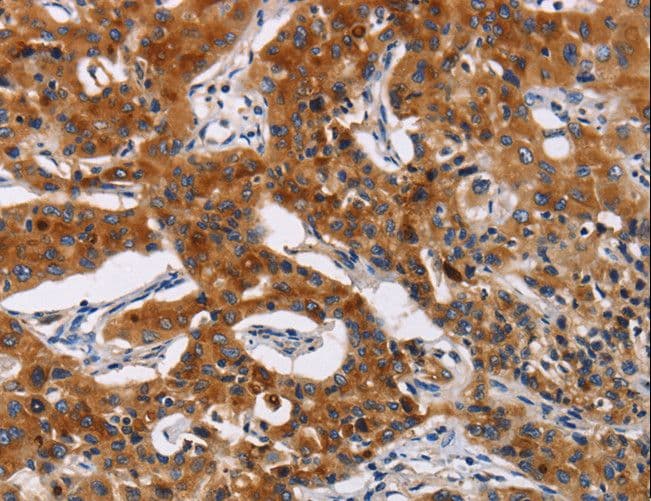MSLN / Mesothelin Antibody
