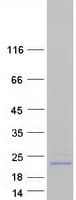Human AVP / ADH / Vasopressin Protein (Recombinant Myc-DDK (Flag))