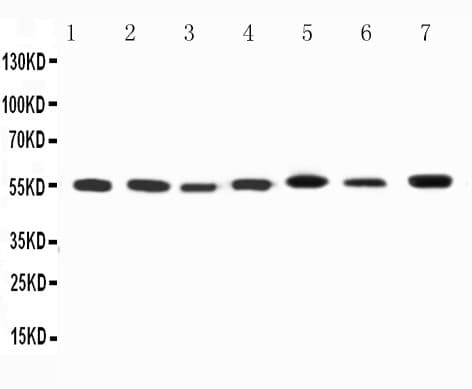 Polyclonal Rabbit anti-Human KCNA1 / Kv1.1 Antibody (aa465-481, WB)