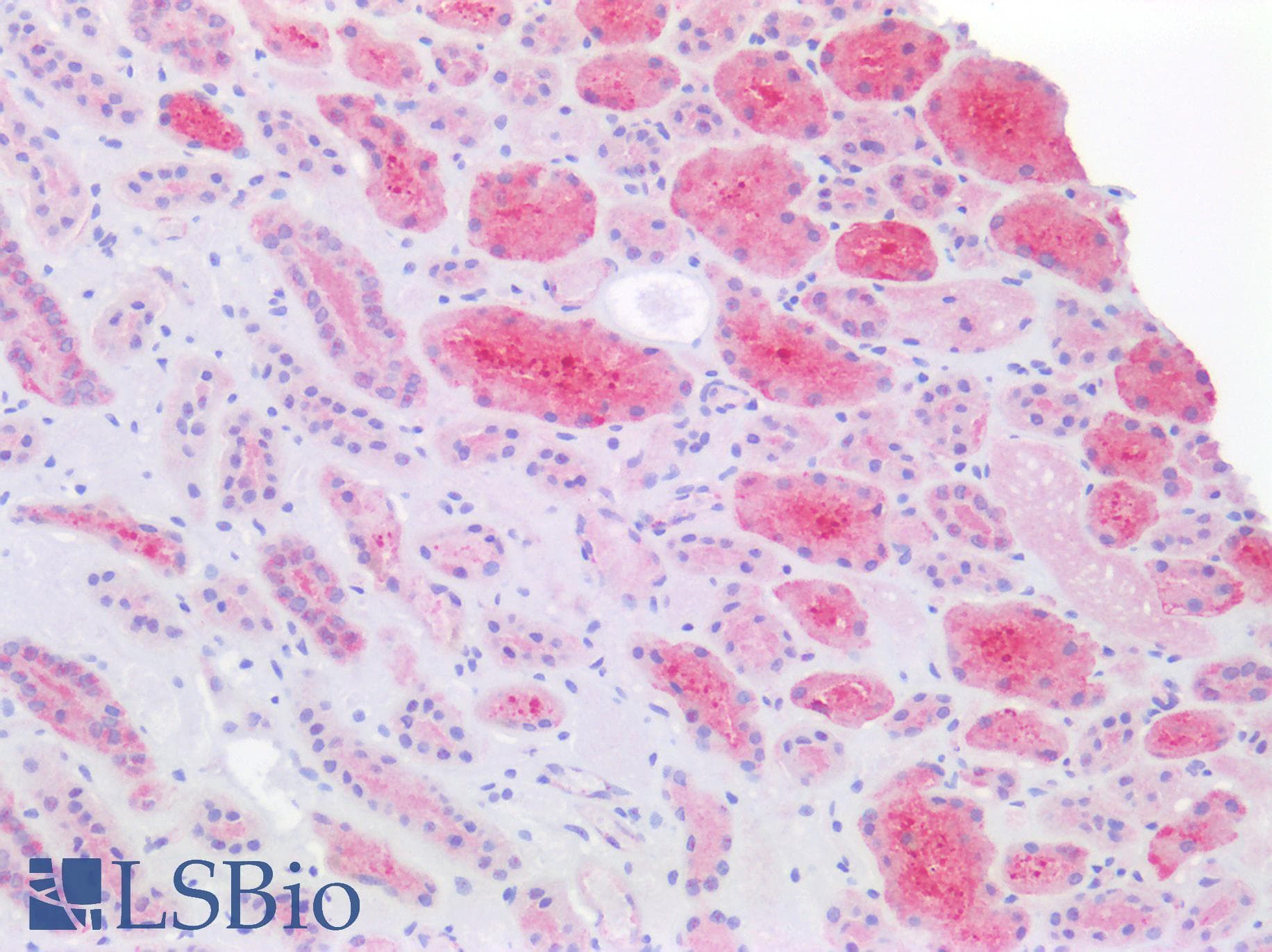 PathPlus™ MVP / VAULT1 Antibody (aa158-380)