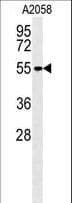 Monoclonal Mouse anti-Human MMP14 Antibody (aa470-499, IF, WB)