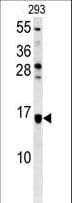 ATXN7L3B Antibody (aa32-62)