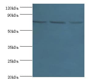 NCL / Nucleolin Antibody (aa411-710)