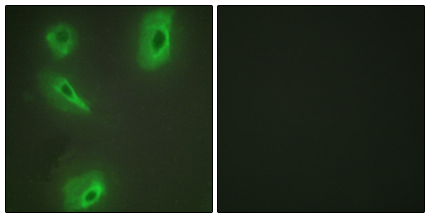 Polyclonal Rabbit anti-Human BCKDK Antibody (aa11-60, IF, WB)