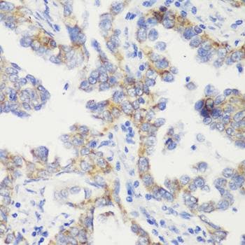 Polyclonal Rabbit anti-Human TOMM20 Antibody (IHC, IF)