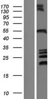 ZFYVE27 / Protrudin Protein (Over-Expression Lysate Myc-DDK (Flag))