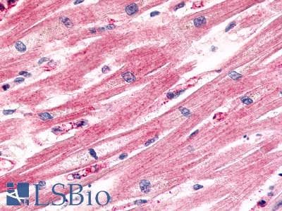 PathPlus™ ACKR4 / CCRL1 / CCR11 Antibody (Cytoplasmic Domain)