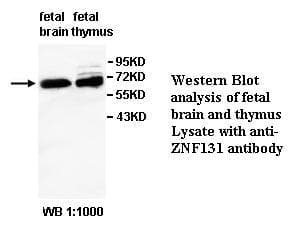 Polyclonal Rabbit anti-Human ZNF131 Antibody (aa137-437, WB)