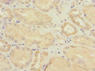 SOCS6 / SOCS-6 Antibody
