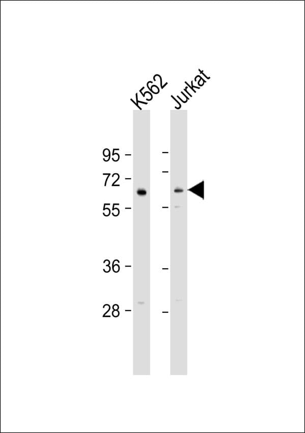 DOK1 Antibody