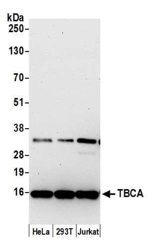 TBCA Antibody (aa58-108)