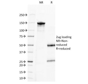 Monoclonal Mouse Progesterone Antibody (clone 6-5E-3F, IHC)