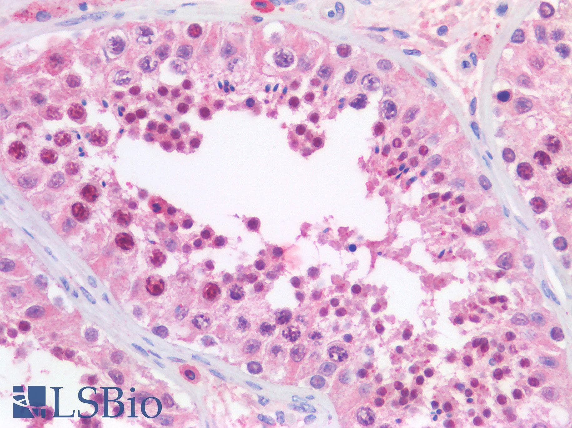IHC-plus™ Polyclonal Goat anti-Human KPNA2 / Importin Alpha 1 Antibody (aa518-529, IHC, WB)