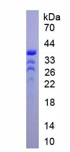 Mouse ZEB2 / SIP-1 Protein (Recombinant His, N-Terminal)
