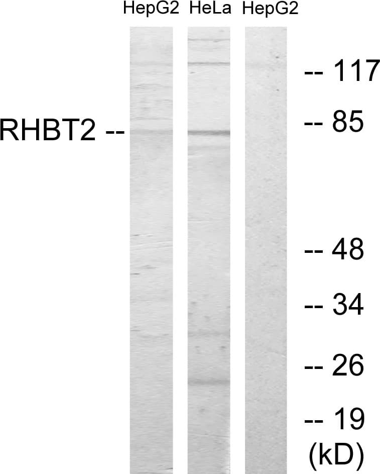 IHC-plus™ Polyclonal Rabbit anti-Human RHOBTB2 / DBC2 Antibody (aa61-110, IHC, WB)