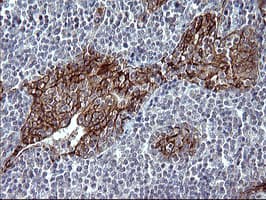 EPCAM Antibody (clone OTI1H9)