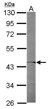 PSMC6 Antibody (aa1-301)