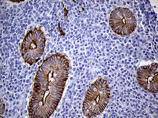 LAD1 Antibody (aa271-517, clone OTI7H8)