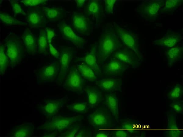 S100A13 Antibody (clone 3A7)