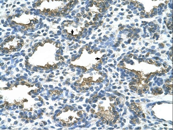 Polyclonal Rabbit anti-Human PLAP / Alkaline Phosphatase Antibody (Biotin, aa411-460, IHC, WB)