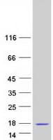 Human SH3BGRL2 Protein (Recombinant Myc-DDK (Flag))