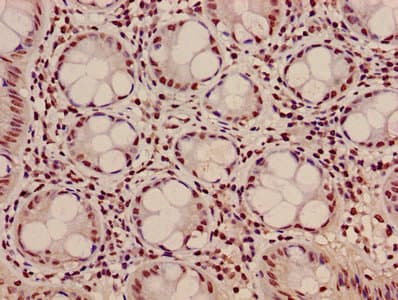 HIST1H3A Antibody