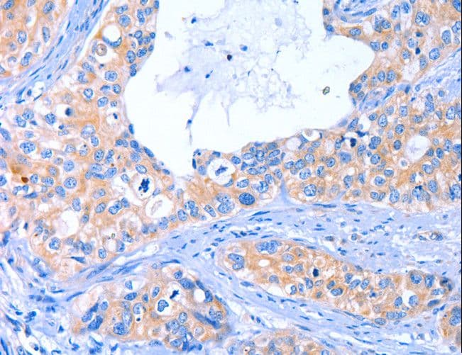 Polyclonal Rabbit anti-Human ARRB1 / Beta Arrestin 1 Antibody (IHC)
