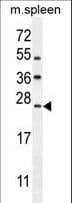 LMO4 Antibody (aa104-131)
