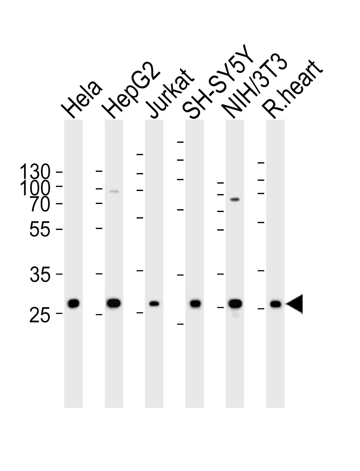 VAPB Antibody (aa126-139)