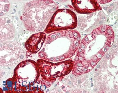 Polyclonal Rabbit anti-Human NOX4 Antibody (aa220-392, IHC, WB)