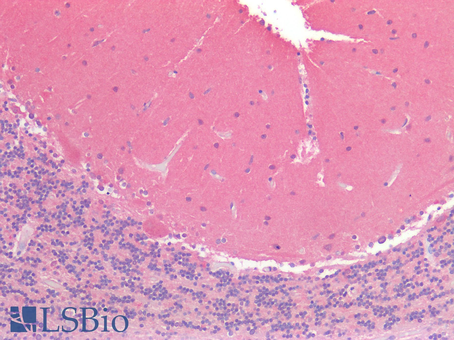 IHC-plus™ OSMR / IL-31R-Beta Antibody (clone 8F3H8B2)