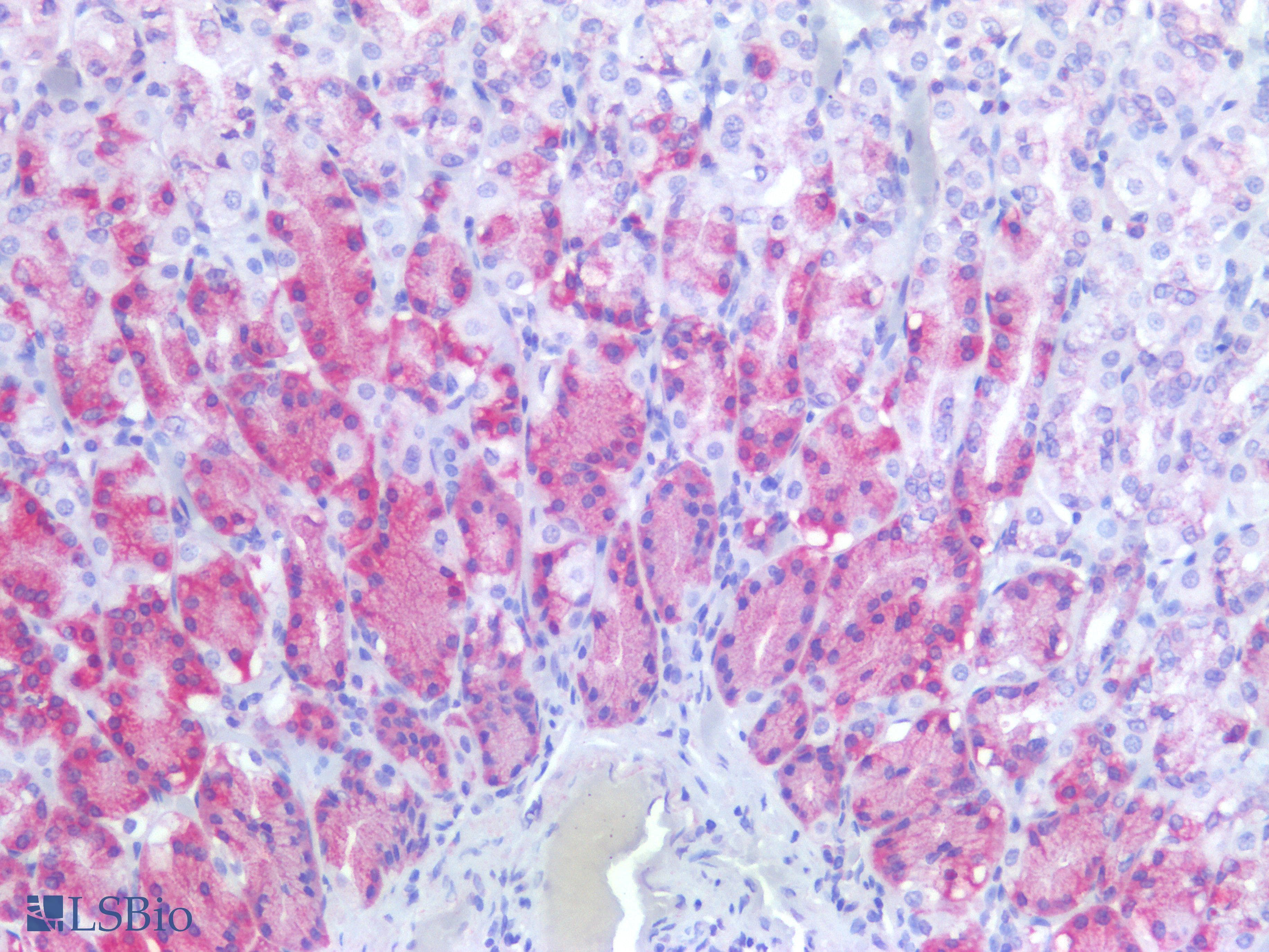 PathPlus™ TGFB1 / TGF Beta 1 Antibody