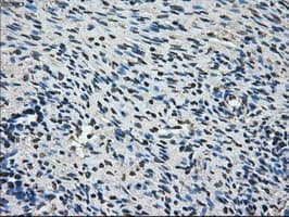 IHC-plus™ Monoclonal Mouse anti-Human AKR1A1 Antibody (clone 10E11, IHC, WB)