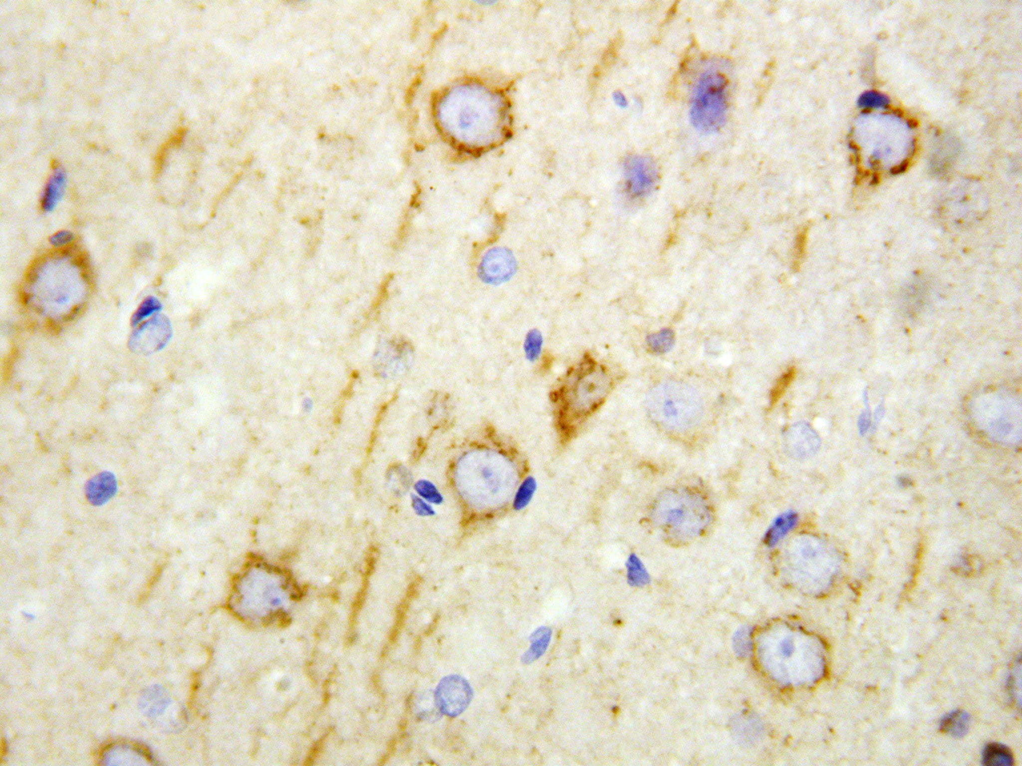 GAD65 Antibody (aa21-37)