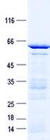 Human ALX1 Protein (Recombinant GST, N-terminus + His, C-terminus)