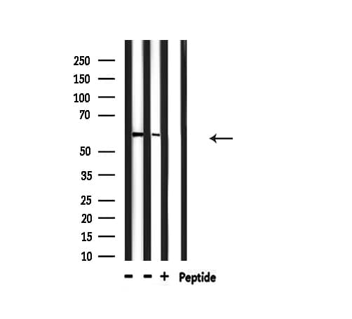PDPK1 / PDK1 Antibody (phospho-Ser241)