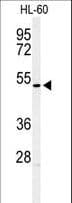IHC-plus™ HOXA3 Antibody (aa413-440)